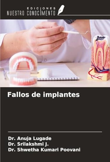 Fallos de implantes
