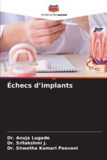 Échecs d'implants