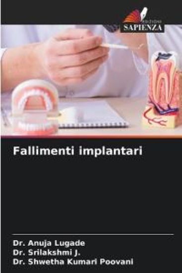 Fallimenti implantari