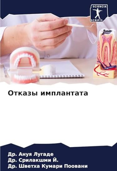Otkazy implantata