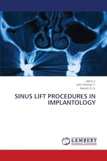 Sinus Lift Procedures in Implantology