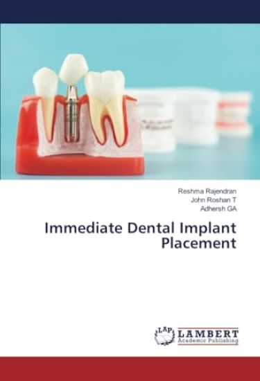 Immediate Dental Implant Placement