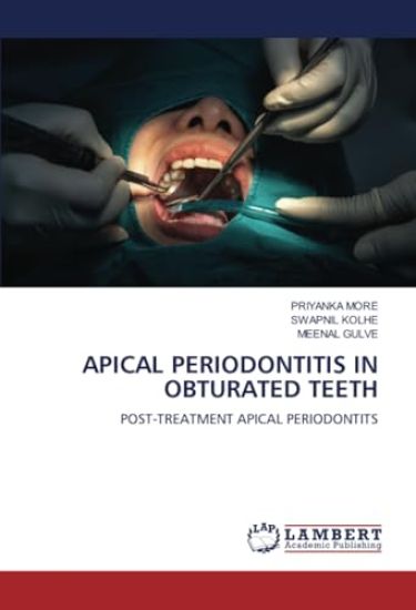 Apical Periodontitis in Obturated Teeth