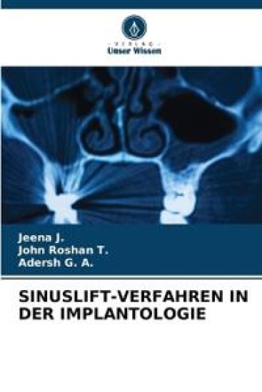 Sinuslift-Verfahren in Der Implantologie