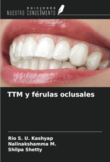 TTM y férulas oclusales