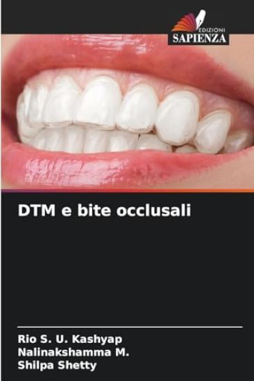 DTM e bite occlusali