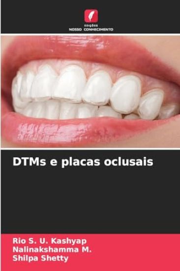 DTMs e placas oclusais