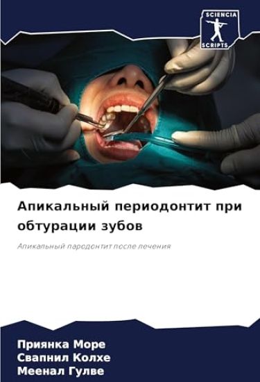 Apikal'nyj periodontit pri obturacii zubow