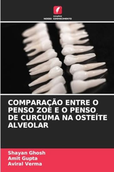 Comparação Entre O Penso Zoe E O Penso de Curcuma Na Osteíte Alveolar – Shayan Ghosh, kirjan kansikuva