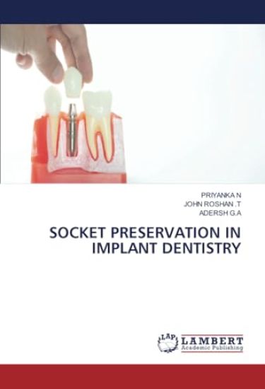 Socket Preservation in Implant Dentistry