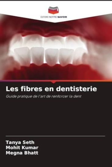 Les fibres en dentisterie