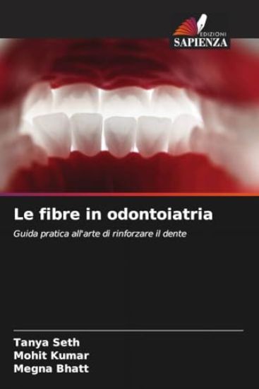 Le fibre in odontoiatria