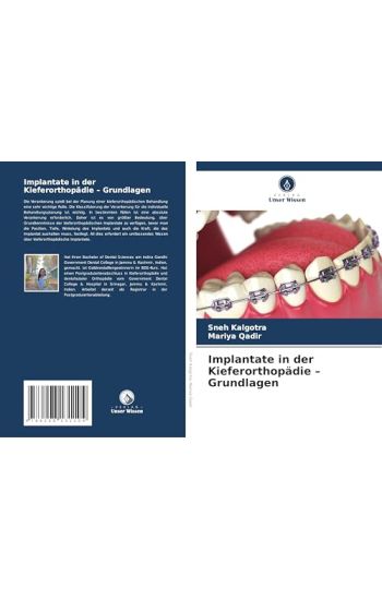 Implantate in der Kieferorthopädie - Grundlagen