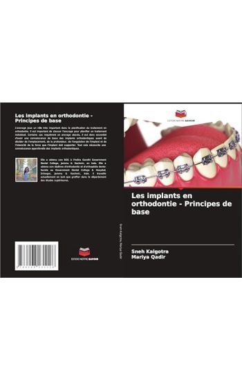 Les implants en orthodontie - Principes de base