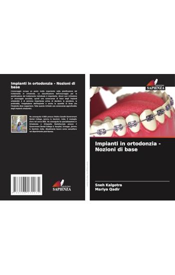 Impianti in ortodonzia - Nozioni di base