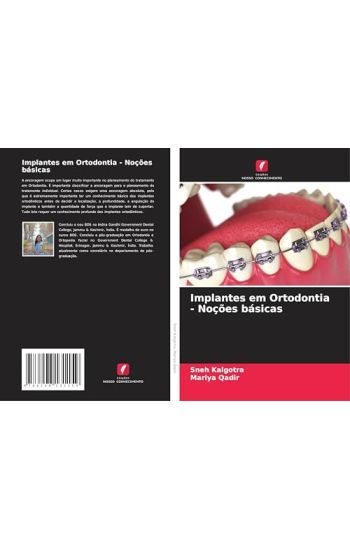 Implantes em Ortodontia - Noções básicas