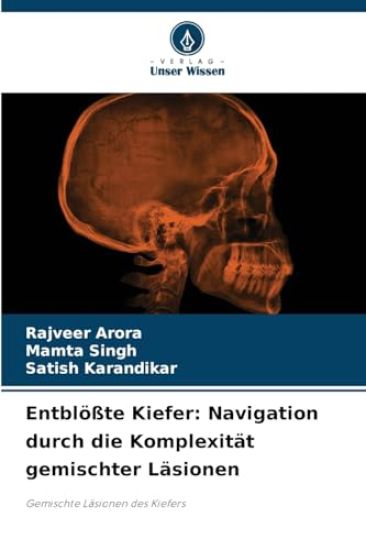 Entblößte Kiefer – Rajveer Arora, kirjan kansikuva