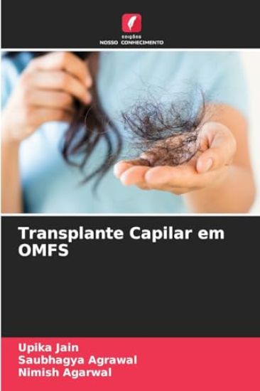 Transplante Capilar em OMFS