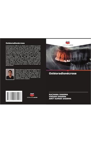 Ostéoradionécrose – Rachana Sharma, kirjan kansikuva