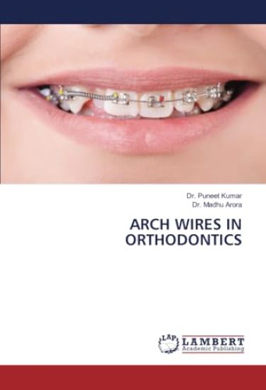 Arch Wires in Orthodontics – Puneet Kumar, kirjan kansikuva