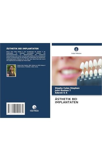 Ästhetik Bei Implantaten