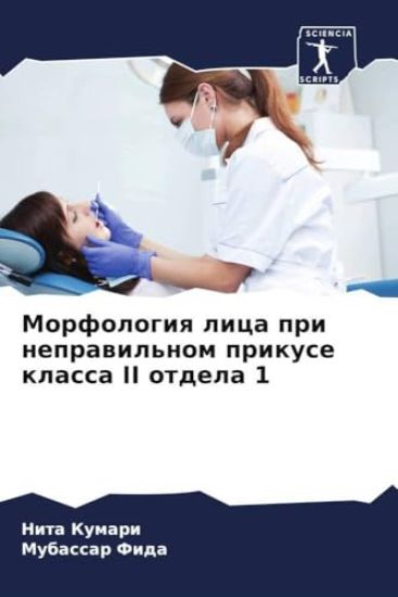 Morfologiq lica pri neprawil'nom prikuse klassa II otdela 1