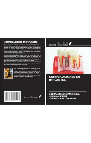 COMPLICACIONES EN IMPLANTES