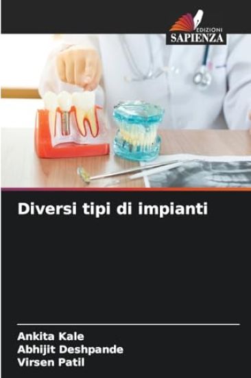 Diversi tipi di impianti