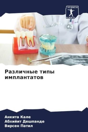 Razlichnye tipy implantatow