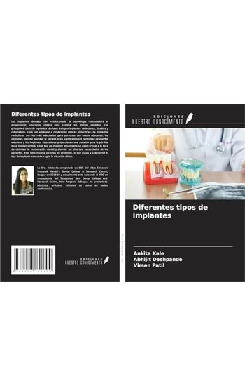 Diferentes tipos de implantes