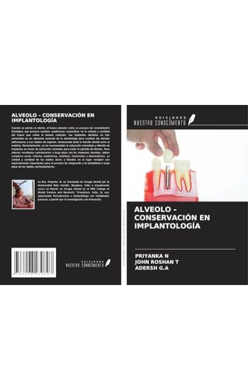 ALVEOLO - CONSERVACIÓN EN IMPLANTOLOGÍA