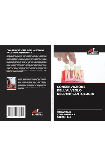 Conservazione Dell'alveolo Nell'implantologia