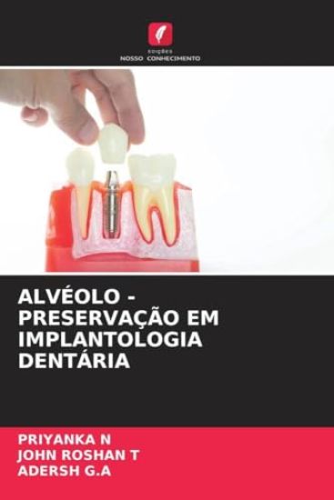 Alvéolo - Preservação Em Implantologia Dentária