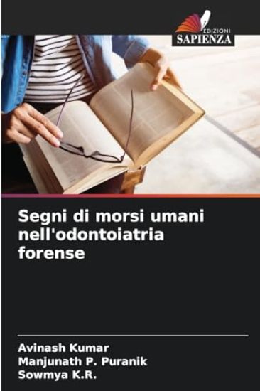 Segni di morsi umani nell'odontoiatria forense