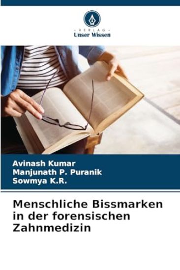 Menschliche Bissmarken in der forensischen Zahnmedizin