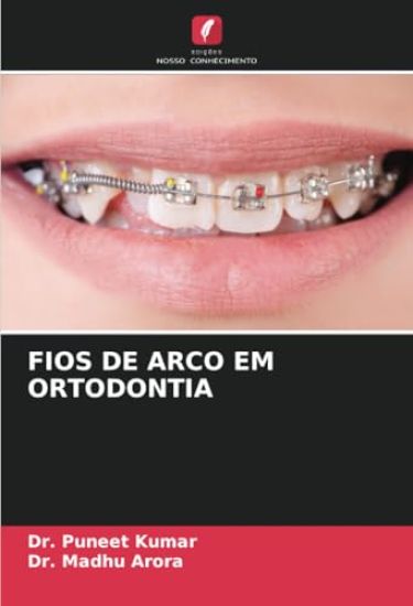 Fios de Arco Em Ortodontia – Puneet Kumar, kirjan kansikuva