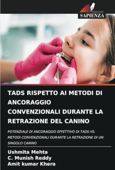 Tads Rispetto AI Metodi Di Ancoraggio Convenzionali Durante La Retrazione del Canino – Ushmita Mehta, kirjan kansikuva