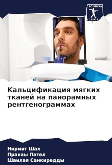 Kal'cifikaciq mqgkih tkanej na panoramnyh rentgenogrammah