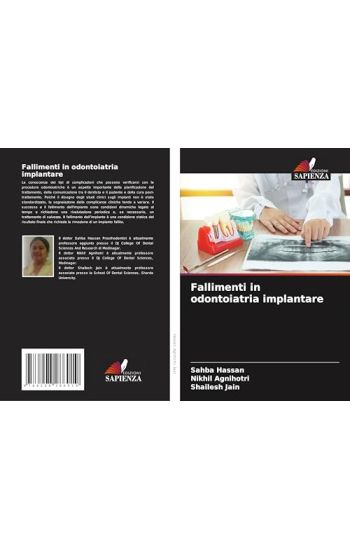 Fallimenti in odontoiatria implantare