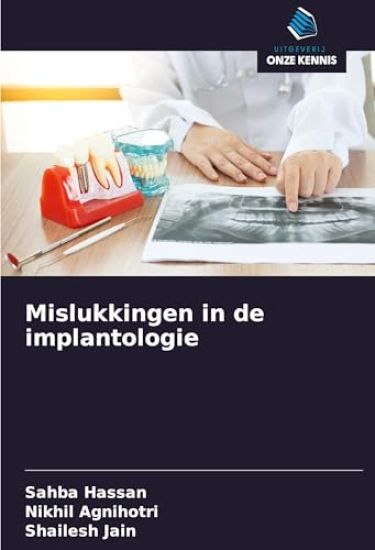 Mislukkingen in de implantologie