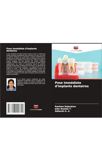 Pose immédiate d'implants dentaires