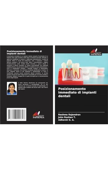 Posizionamento immediato di impianti dentali