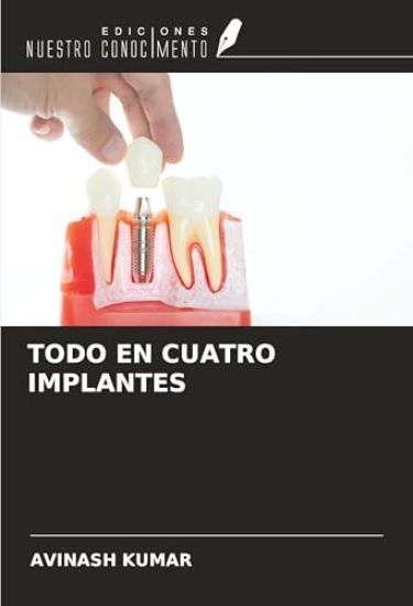 TODO EN CUATRO IMPLANTES