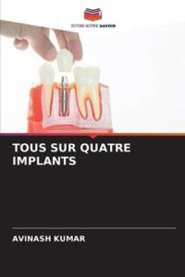 Tous Sur Quatre Implants