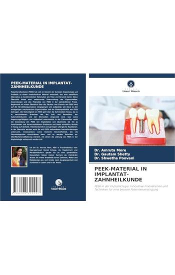 Peek-Material in Implantat-Zahnheilkunde