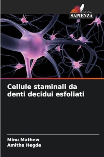Cellule staminali da denti decidui esfoliati