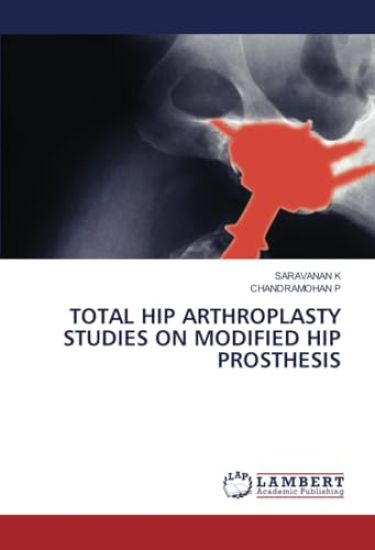Total Hip Arthroplasty Studies on Modified Hip Prosthesis