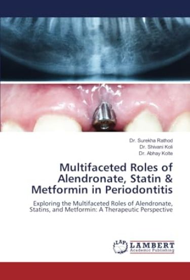 Multifaceted Roles of Alendronate, Statin & Metformin in Periodontitis