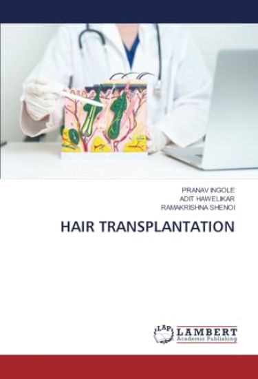 Hair Transplantation
