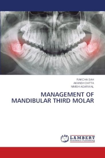 Management of Mandibular Third Molar